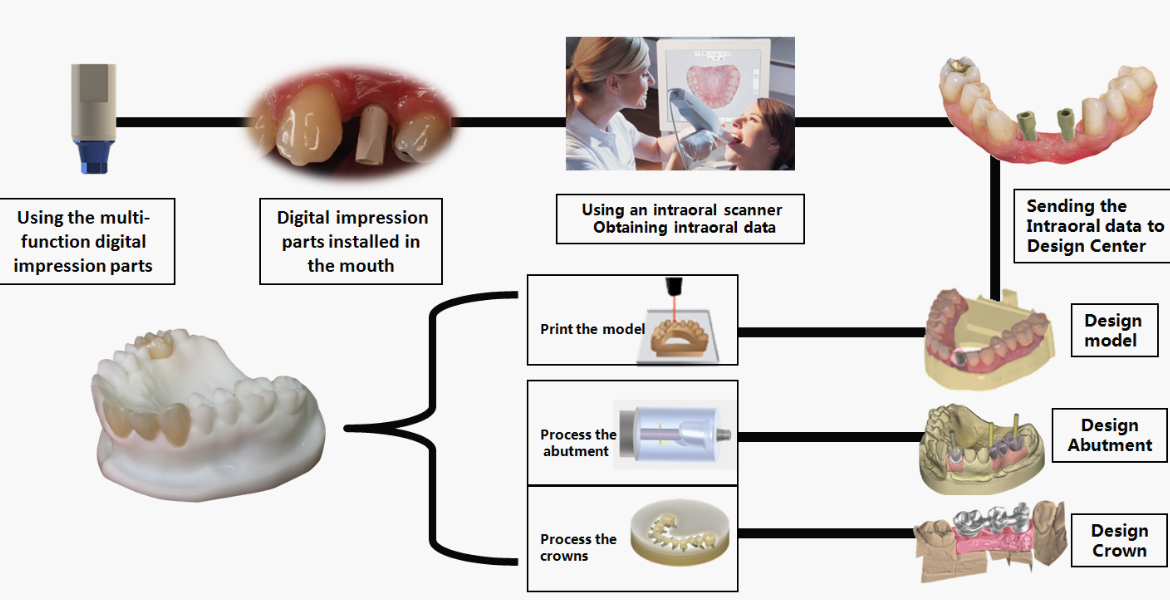 Crown and Bridge Works from China