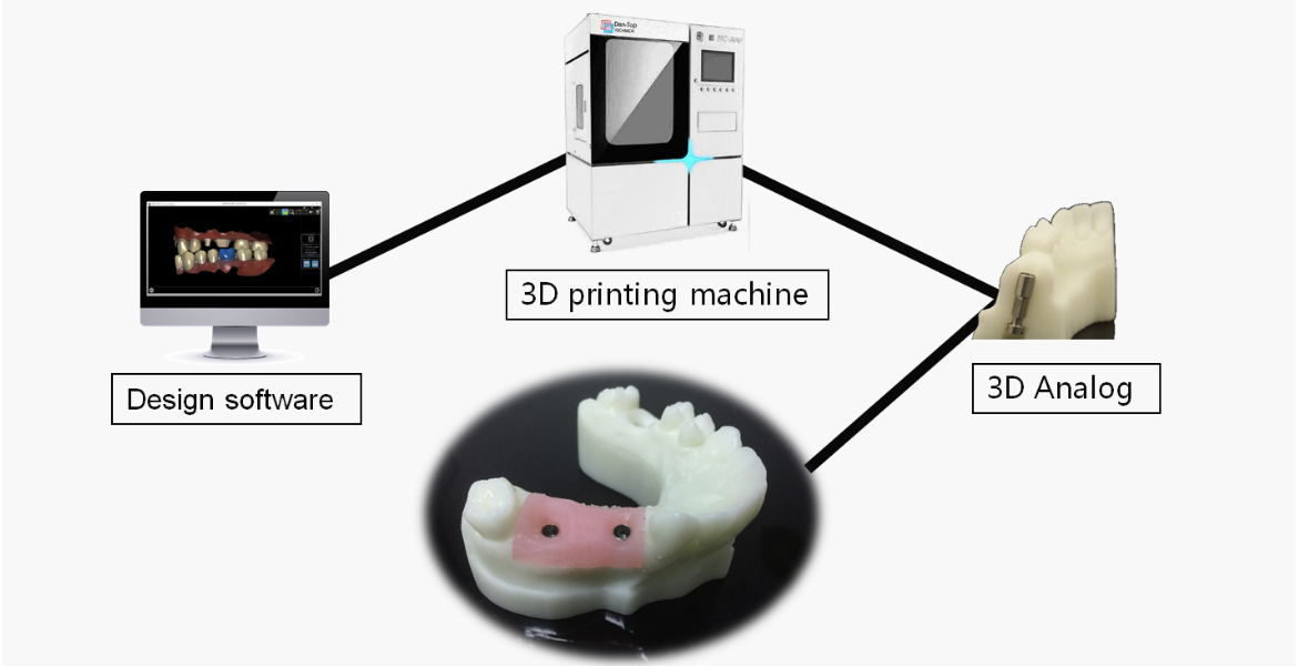 Zirconia Crown in China