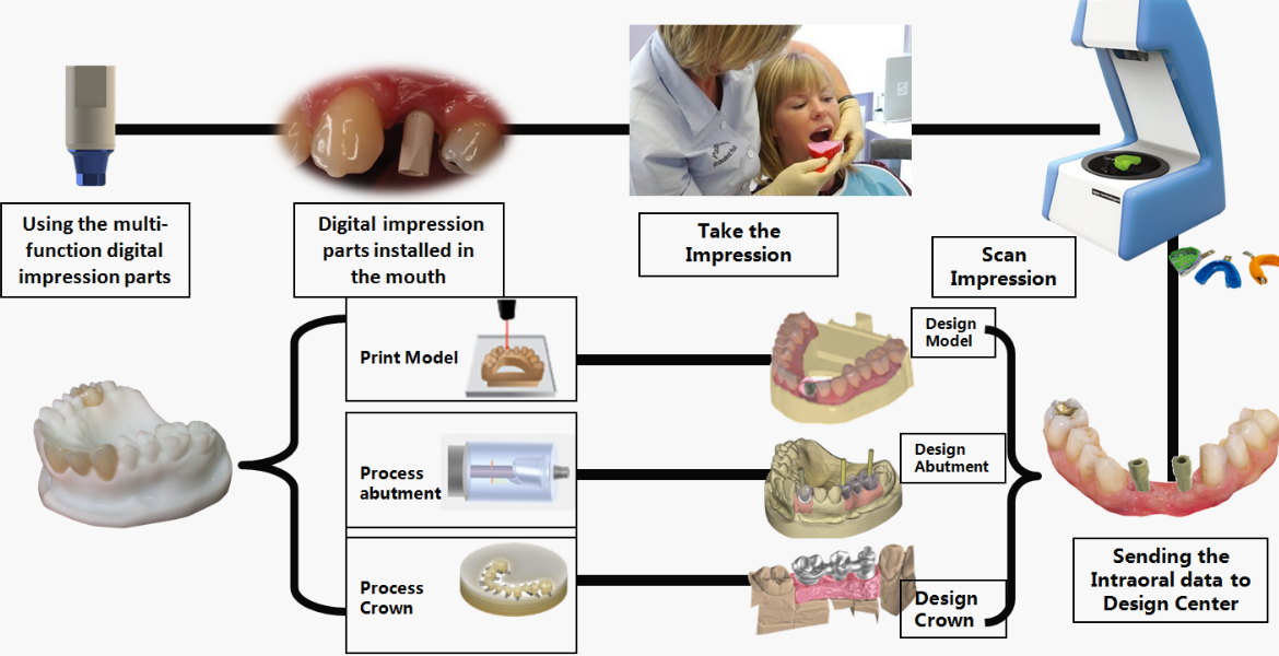 China Crown and Bridge